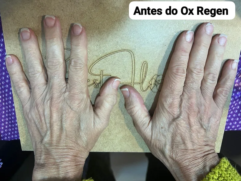 Mão antes OX REGEN